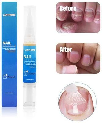 ⚡️ Lanthome Nail Repair ⚡️